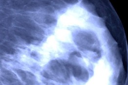 mammogram_d_200910210845401